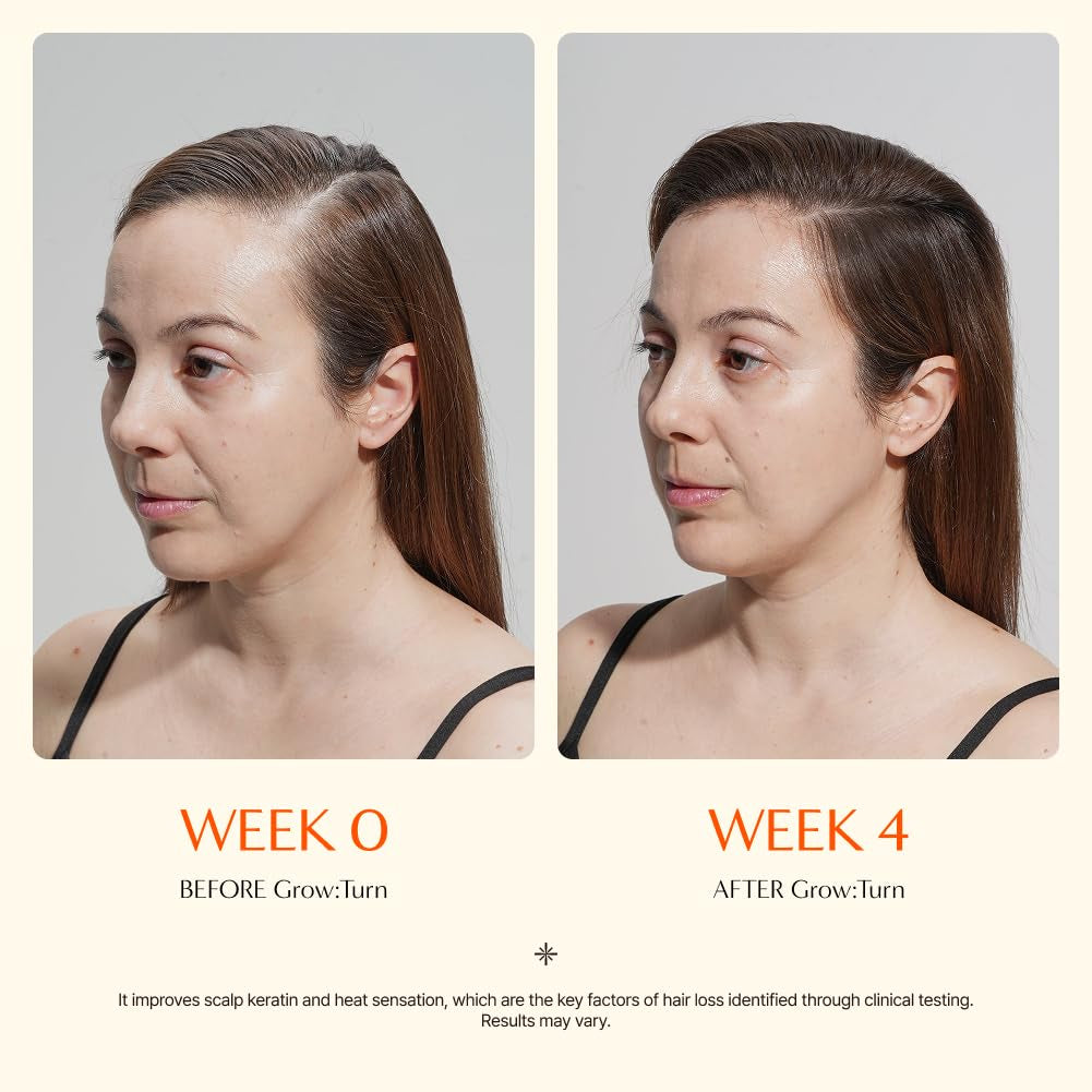 Growturn Precision Hair Growth Scalp Serum