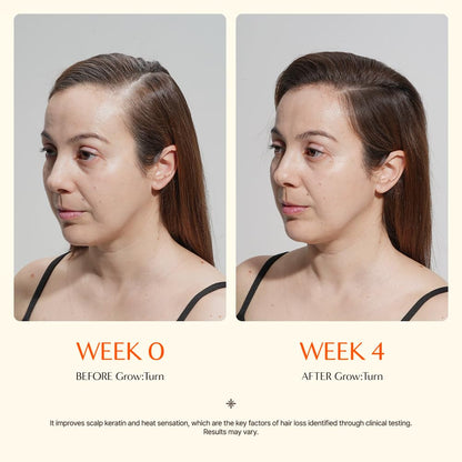 Growturn Precision Hair Growth Scalp Serum